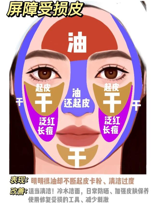 如何区别自己是什么肤质（看图正确判断自己的肤质）